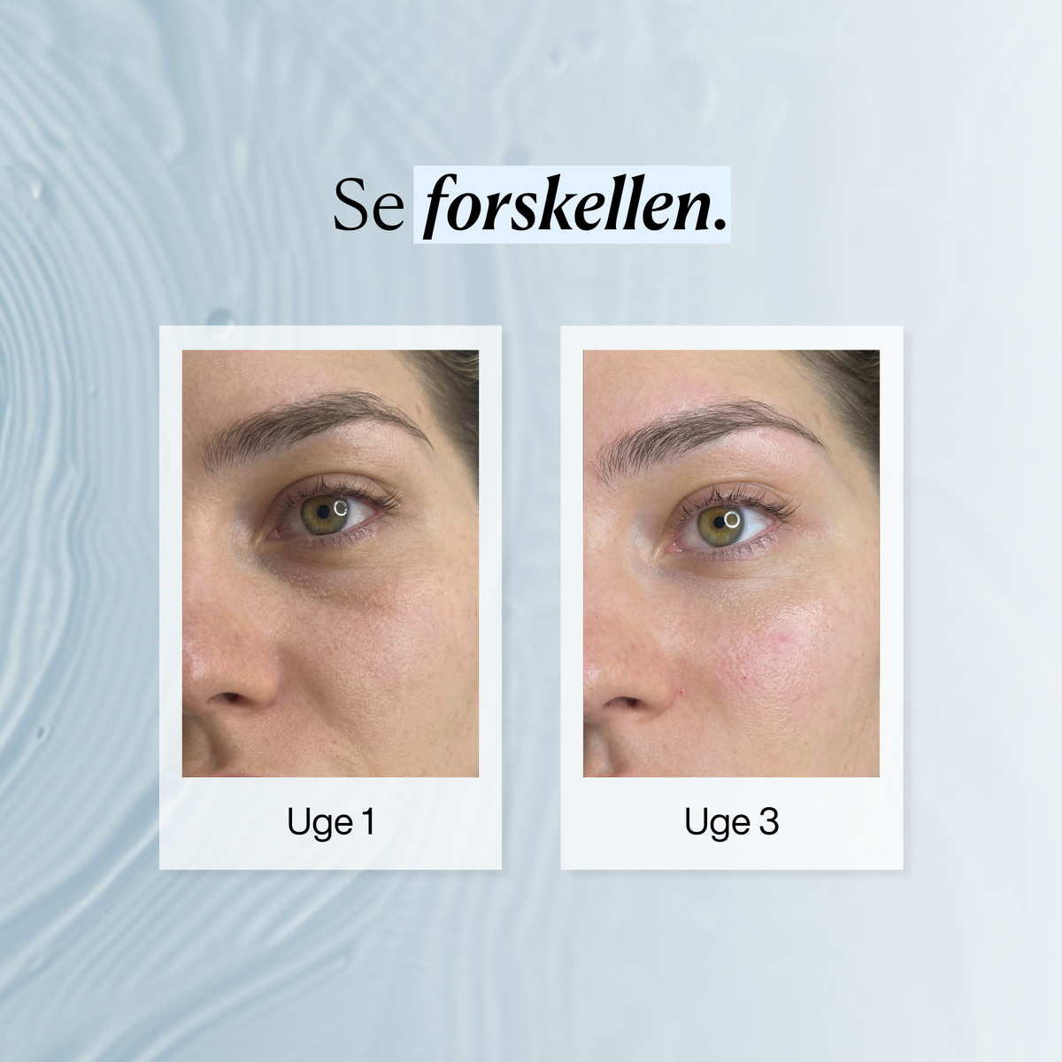 Øjenmasker mod Hævelser og Mørke Rande