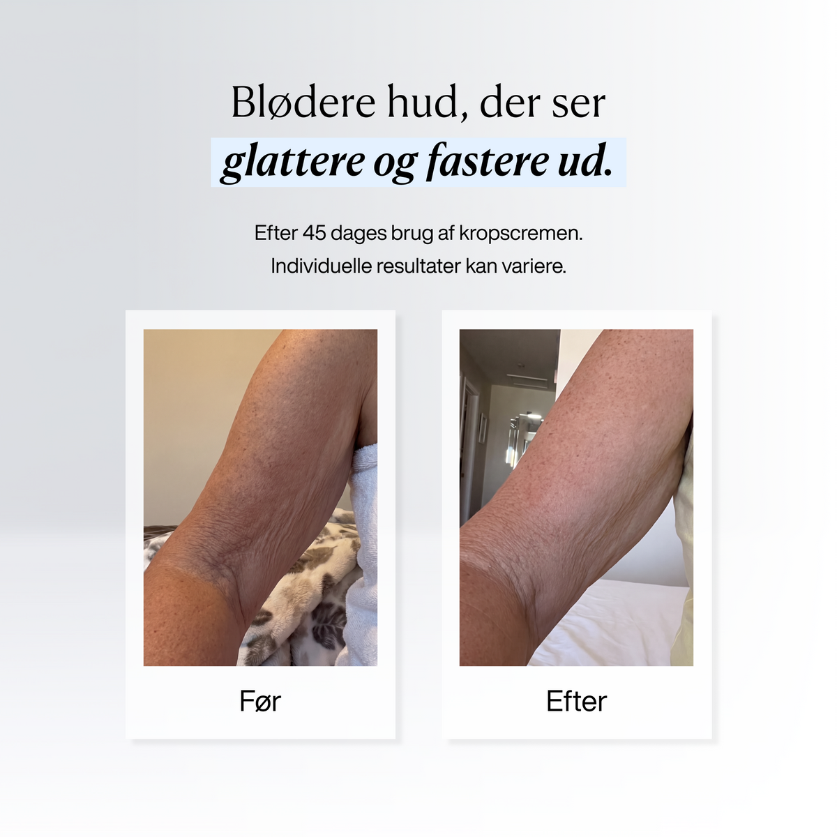 Hudpleje Pakken