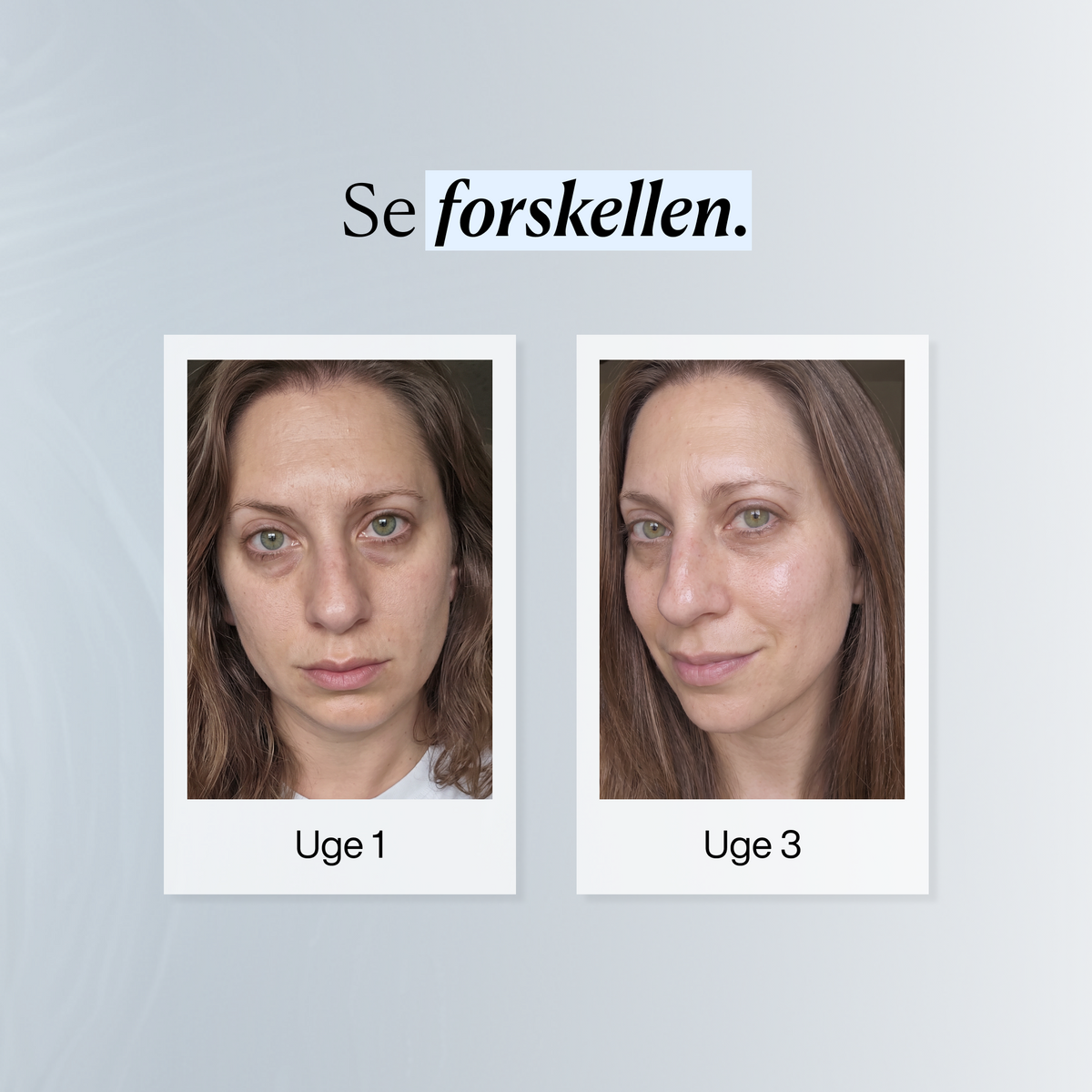 Fugtgivende Kollagenmaske