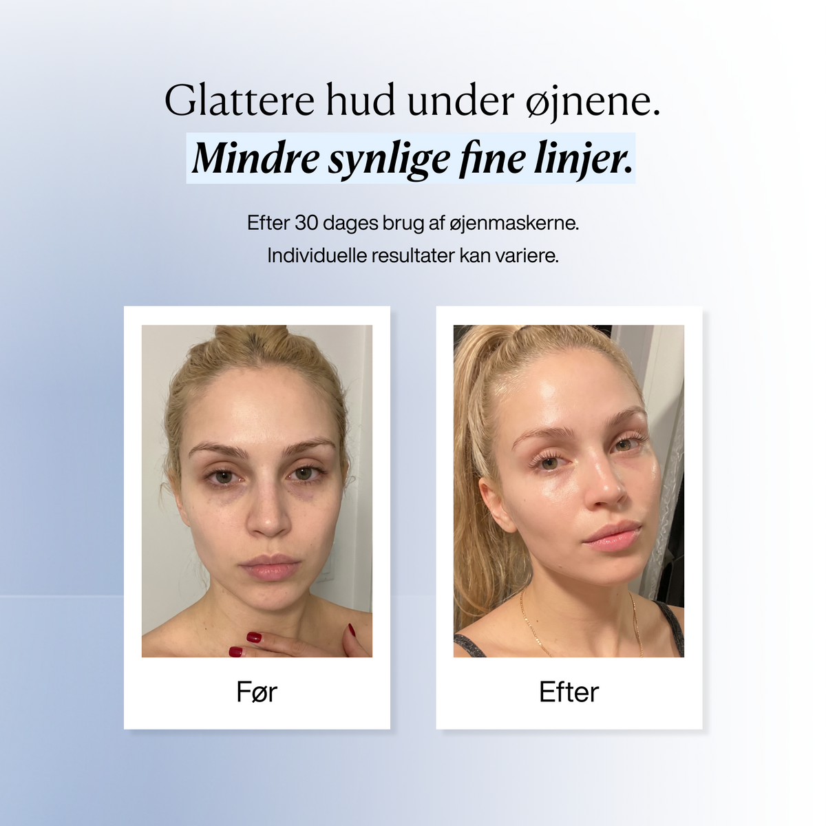 Øjenmasker mod Hævelser og Mørke Rande