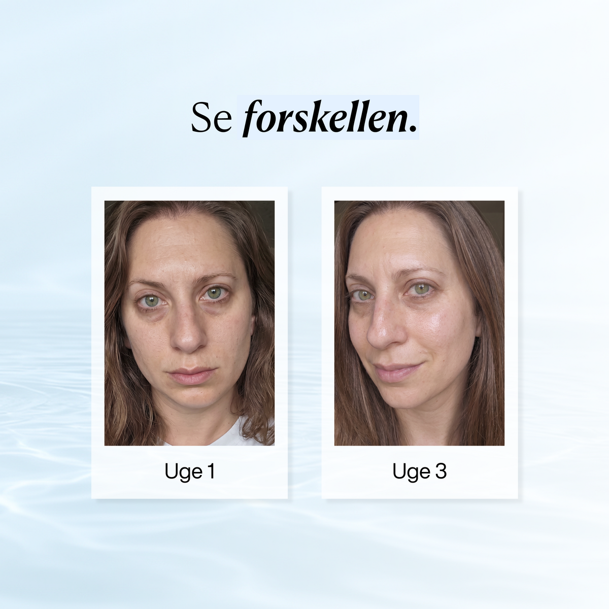 Hudpleje Pakken